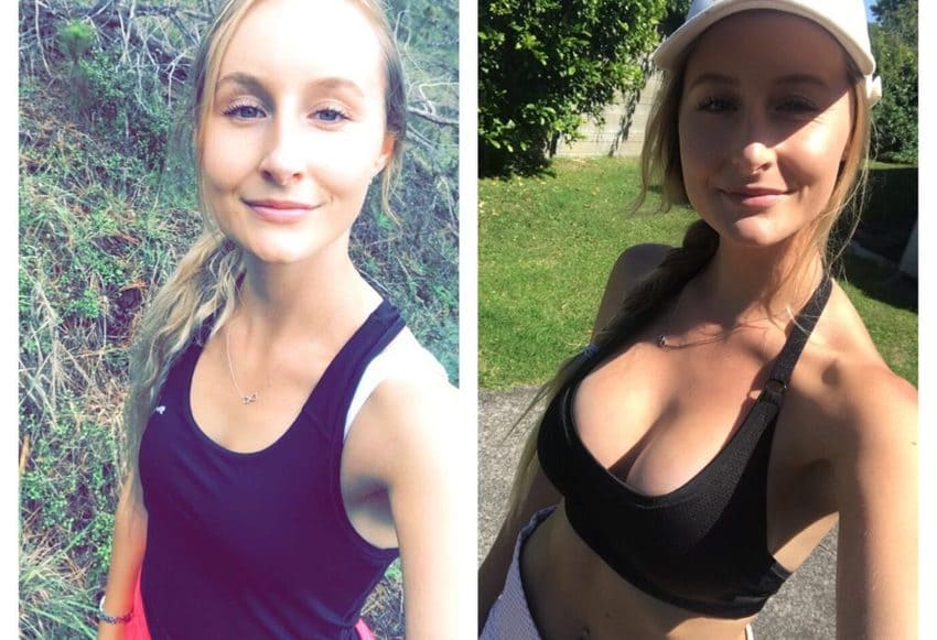 Фотографии увеличения груди до и после
