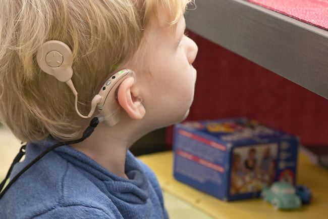 cochlear-implant-price-istanbul-turkey.jpg